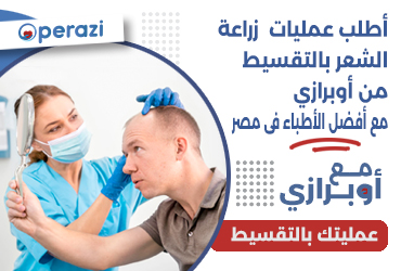 اطلب عمليات زراعة الشعر بالتقسيط من اوبرازي مع افضل الاطباء في مصر 